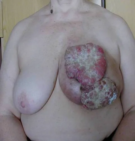 Picture1