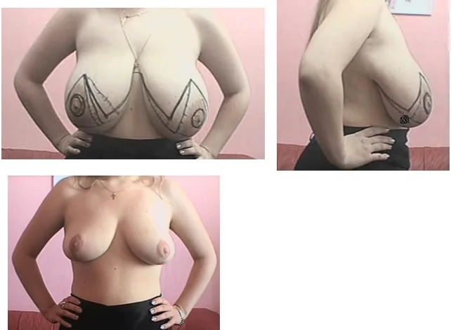 pp2